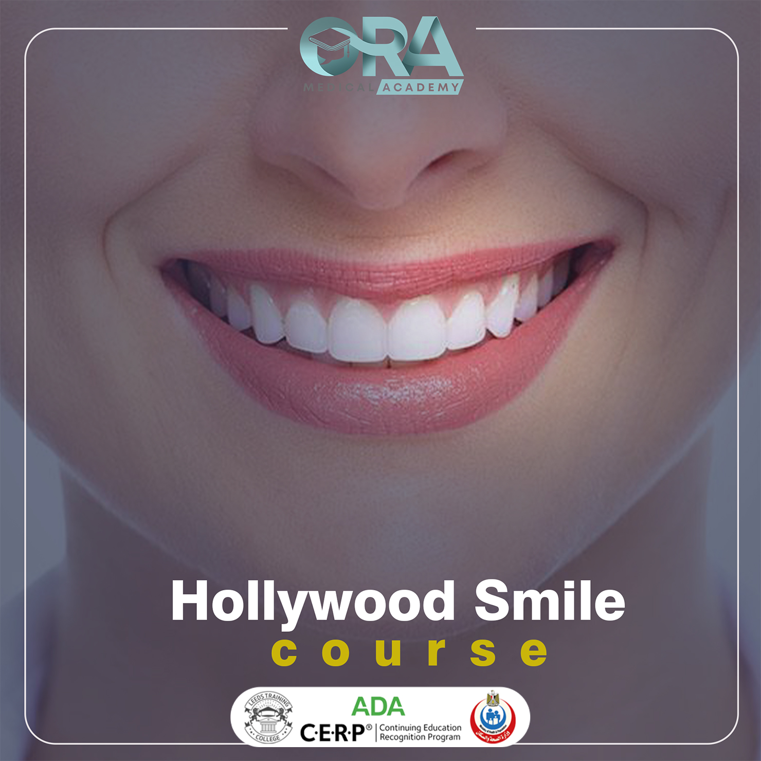 Hollywood smile